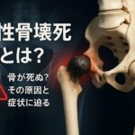 急性骨壊死は他人事じゃない!BoAの症例から学ぶ病気の初期サインと対処法!