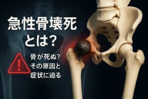急性骨壊死は他人事じゃない！BoAの症例から学ぶ病気の初期サインと対処法！
